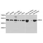 Western blot analysis of extracts of various cell lines, using MICA antibody (abx001216) at 1/1000 dilution.