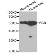 Western blot analysis of extracts of various cell lines, using FGB antibody (abx001220) at 1/1000 dilution.