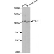 Western blot analysis of extracts of various cell lines, using PTPN22 antibody (abx001222) at 1/1000 dilution.