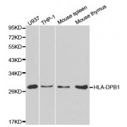 Western blot analysis of extracts of various cell lines, using HLA-DPB1 antibody (abx001225) at 1/1000 dilution.