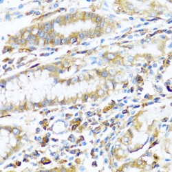 HLA Class II Histocompatibility Antigen, DP Beta 1 Chain (HLA-DPB1) Antibody
