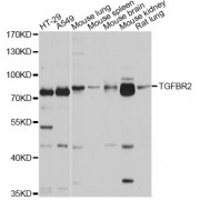 Western blot analysis of extracts of various cell lines, using TGFBR2 antibody (abx001227) at 1/1000 dilution.