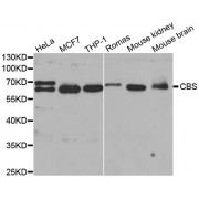 Western blot analysis of extracts of various cell lines, using CBS antibody (abx001233) at 1/1000 dilution.