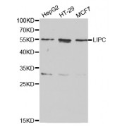 Western blot analysis of extracts of various cell lines, using LIPC antibody (abx001234) at 1/1000 dilution.