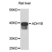 Western blot analysis of extracts of rat liver, using ADH1B antibody (abx001235) at 1/1000 dilution.