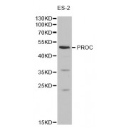 Western blot analysis of extracts of ES-2 cells, using PROC antibody (abx001236) at 1/1000 dilution.