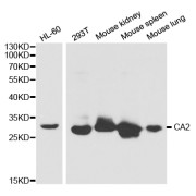 Western blot analysis of extracts of various cell lines, using CA2 antibody (abx001239) at 1/1000 dilution.