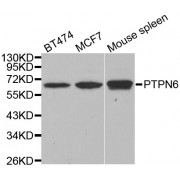 Western blot analysis of extracts of various cell lines, using PTPN6 antibody (abx001240) at 1/1000 dilution.