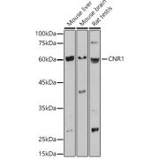 Western blot analysis of extracts of various cell lines, using CNR1 antibody (1/1000 dilution).