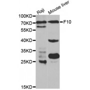 Western blot analysis of extracts of various cell lines, using F10 antibody (abx001245) at 1/1000 dilution.