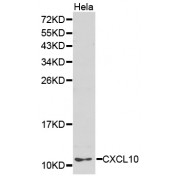 Western blot analysis of extracts of HeLa cells, using CXCL10 antibody (abx001247).