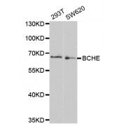 Western blot analysis of extracts of various cell lines, using BCHE antibody (abx001249) at 1/1000 dilution.