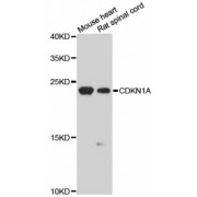 Western blot analysis of extracts of various cell lines, using CDKN1A antibody (abx001260) at 1/1000 dilution.