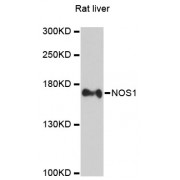 Western blot analysis of extracts of rat liver, using NOS1 antibody (abx001261) at 1/2000 dilution.