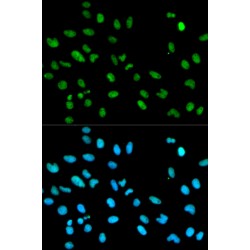 Histone-Binding Protein RBBP4 (RBBP4) Antibody