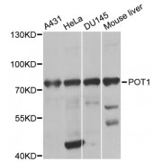 Western blot analysis of extracts of various cell lines, using POT1 antibody (abx001265) at 1/1000 dilution.
