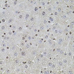 Protection of Telomeres Protein 1 (POT1) Antibody