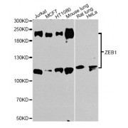 Western blot analysis of extracts of various cell lines, using ZEB1 antibody (abx001268) at 1/1000 dilution.