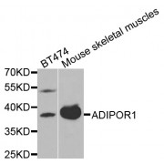 Western blot analysis of extracts of various cell lines, using ADIPOR1 antibody (abx001271) at 1/1000 dilution.