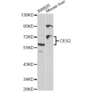 Western blot analysis of extracts of various cell lines, using CES2 antibody (abx001275) at 1/1000 dilution.