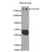 Western blot analysis of extracts of mouse lung, using COL5A1 antibody (abx001276) at 1/500 dilution.