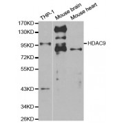 Western blot analysis of extracts of various cell lines, using HDAC9 antibody (abx001277) at 1/500 dilution.