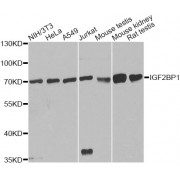 Western blot analysis of extracts of various cell lines, using IGF2BP1 antibody (abx001278) at 1/1000 dilution.