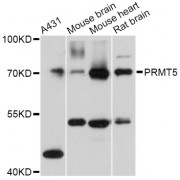 Western blot analysis of extracts of various cell lines, using PRMT5 Antibody (abx001281) at 1:3000 dilution.