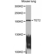 Western blot analysis of extracts of mouse lung, using TET2 antibody (abx001284) at 1/1000 dilution.