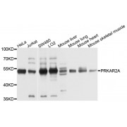 Western blot analysis of extracts of various cell lines, using PRKAR2A antibody (abx001289) at 1/1000 dilution.