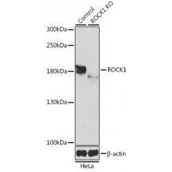 Protein Kinase cAMP-Dependent Type II Regulatory Subunit Alpha (PRKAR2A) Antibody