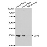 Western blot analysis of extracts of various cell lines, using UCP3 antibody (abx001290) at 1/1000 dilution.