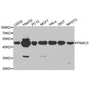 Western blot analysis of extracts of various cell lines, using PSMC5 antibody (abx001295) at 1/1000 dilution.