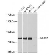 Western blot analysis of extracts of various cell lines, using NFATC1 antibody (abx001296) at 1:3000 dilution.