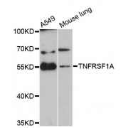 Western blot analysis of extracts of various cell lines, using TNFRSF1A antibody (abx001297) at 1:3000 dilution.