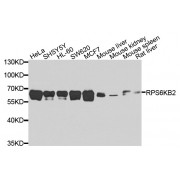 Western blot analysis of extracts of various cell lines, using RPS6KB2 antibody (abx001298) at 1/1000 dilution.