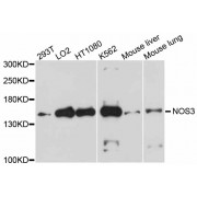 Western blot analysis of extracts of various cell lines, using NOS3 antibody (abx001303) at 1/1000 dilution.