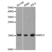 Western blot analysis of extracts of various cell lines, using BIRC5 antibody (abx001305) at 1/1000 dilution.