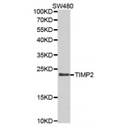 Western blot analysis of extracts of SW480 cells, using TIMP2 antibody (abx001309) at 1/1000 dilution.