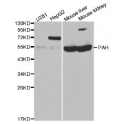 Western blot analysis of extracts of various cell lines, using PAH antibody (abx001310) at 1/1000 dilution.