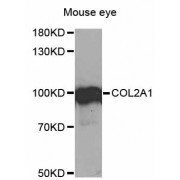 Western blot analysis of extracts of mouse eye, using COL2A1 antibody (abx001311) at 1/1000 dilution.