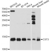 Western blot analysis of extracts of various cell lines, using CST3 antibody (abx001312) at 1/1000 dilution.