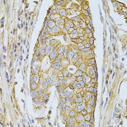 Basigin (BSG) Antibody