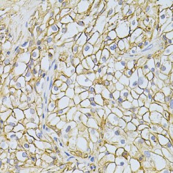 Basigin (BSG) Antibody