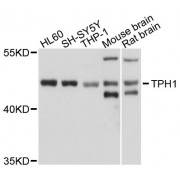Western blot analysis of extracts of various cell lines, using TPH1 antibody (abx001320) at 1/1000 dilution.