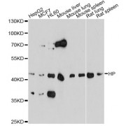 Western blot analysis of extracts of various cell lines, using HP antibody (1/1000 dilution).