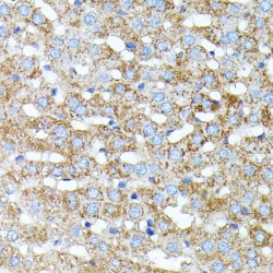 Haptoglobin / Zonulin Proprotein (HP) Antibody