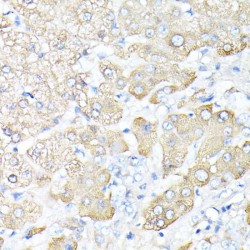 Haptoglobin / Zonulin Proprotein (HP) Antibody