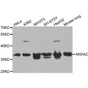 Western blot analysis of extracts of various cell lines, using ANXA2 antibody (abx001323) at 1/1000 dilution.
