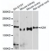 Western blot analysis of extracts of various cell lines, using A2M antibody (abx001324) at 1/500 dilution.